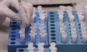 Ministério da Saúde autoriza laboratório da Paraíba a realizar testes de coronavírus