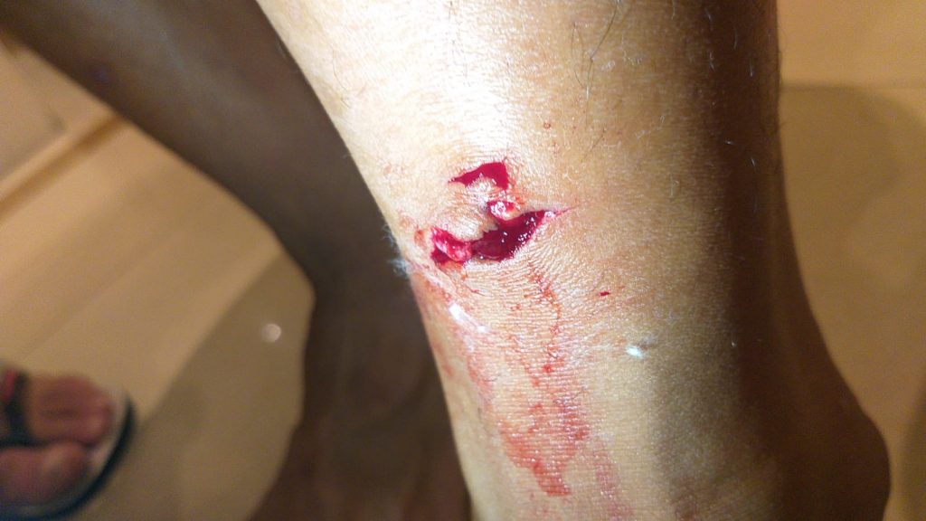 Jogador do Campinense sai ferido após confronto iniciado por torcida do América-RN, em Natal